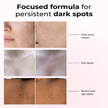 Lumen Drop - Anti-spot & pigment correction serum