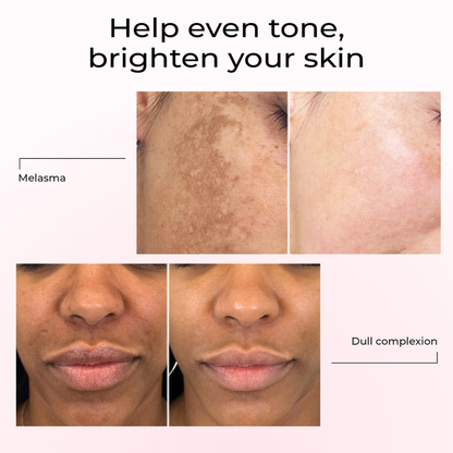 Lumen Drop - Anti-spot & pigment correction serum