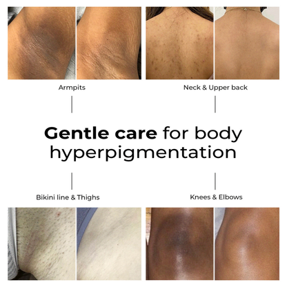 Lumen Drop - Anti-spot & pigment correction serum